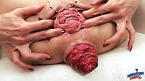 EXTREME PROLAPSE Pumping and Destroyed Pussy MILF Sasha from ArgentinaNaked porn extreme prolapse pumping and destroyed pussy milf sasha from argentinanaked sex