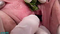 porn xxxxx nettles in peehole urethral insertion nettles fisting cunt sex